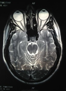 My actual personal brain!
